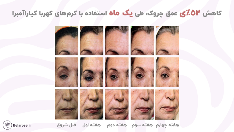کاهش 52%ی عمق چروک با کرم های کهربا کیارا آمبرا