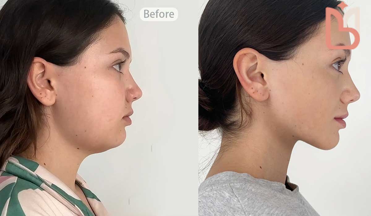 عملکرد یوگای جوان ساز پوست صورت